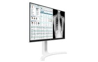 Monitor 27" LG 27HJ712C-W.AEU 8MP Clinical Review, Panel Type: IPS ,Resolution: 3840x2160, Brightness: 350cd/m2, Response Time: - 2